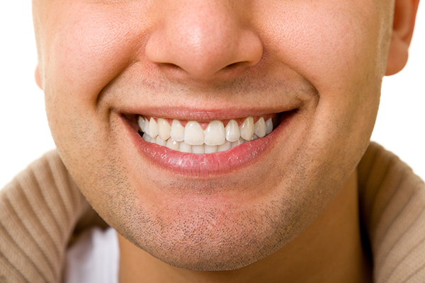 Learn About A New Smile Using Dental Veneers