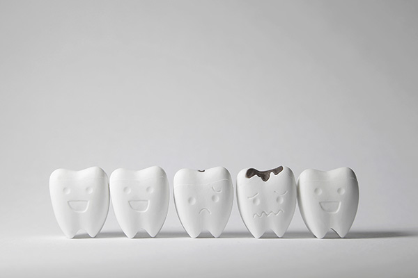 How a General Dentist Can Treat Tooth Decay from Mitra H. Bral, DDS in West Hollywood, CA