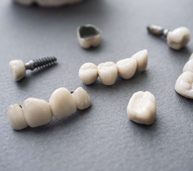 West Hollywood The Difference Between Dental Implants and Mini Dental Implants