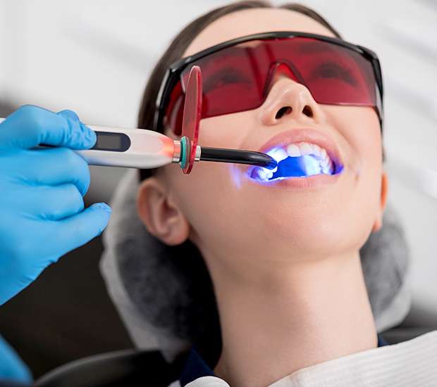West Hollywood Professional Teeth Whitening